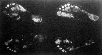 Német városi ember lába (balra) és német nemes lába (jobbra)