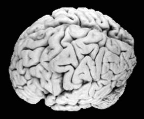 Az emberi agy