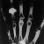 Röntgen-fénykép az emberi kéz csont vázáról