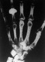 Röntgen-fénykép az emberi kéz csont vázáról